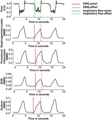 Semi-automated Detection of the Timing of Respiratory Muscle Activity: Validation and First Application